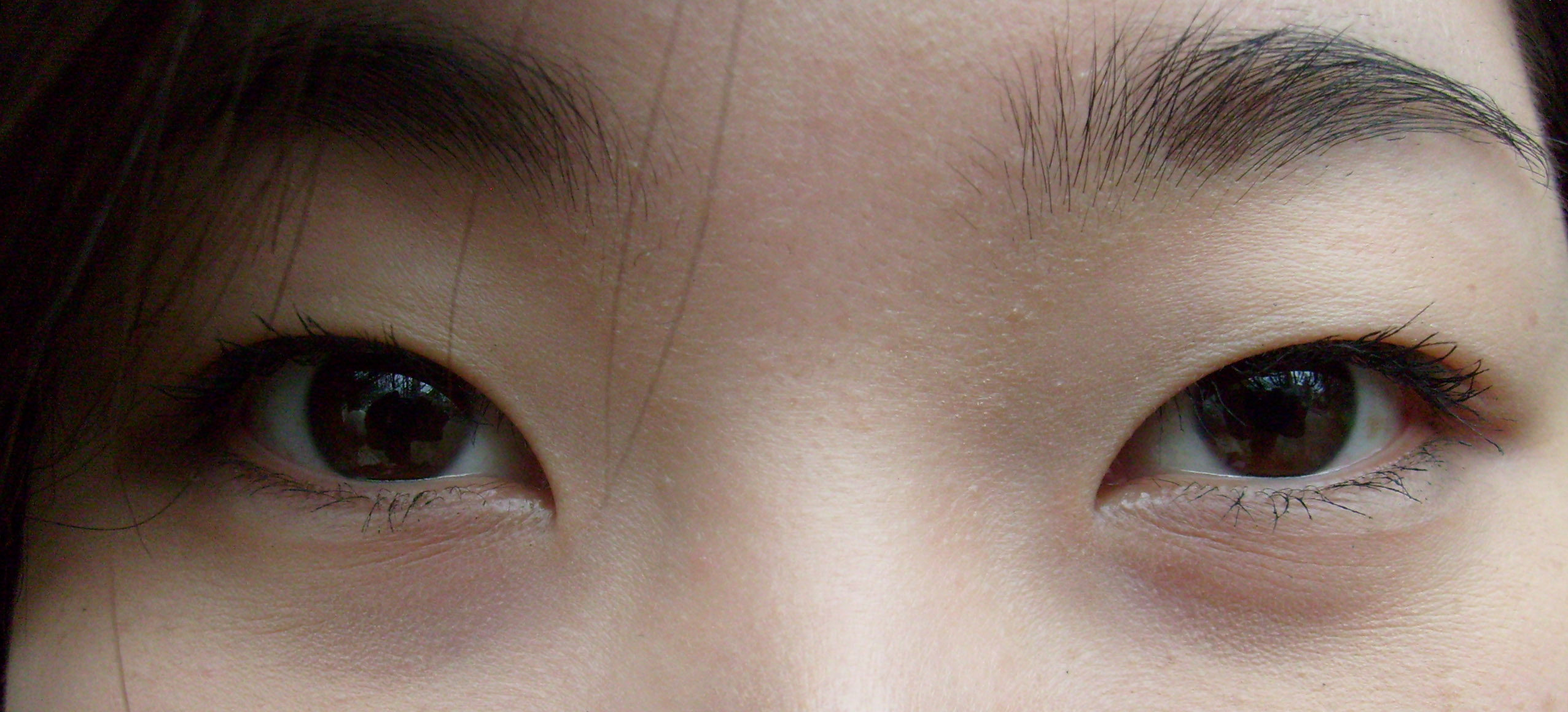 The Western Eye: How I Learned to Live With My Eyelids Global Comment.